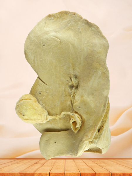 Liver of cattle medical specimen plastination