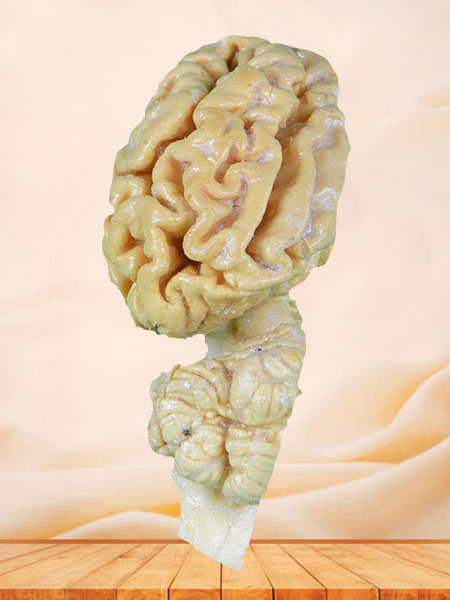 Pig brain hemisphere plastinated specimen