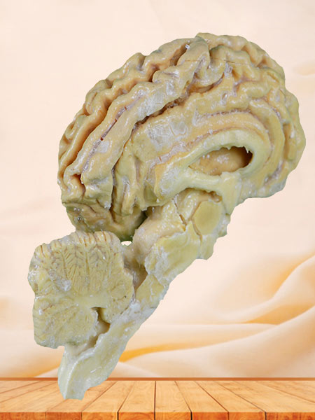 Pig brain hemisphere plastinated specimen