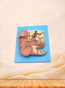 Soft Simulated Pathological Spleen Model