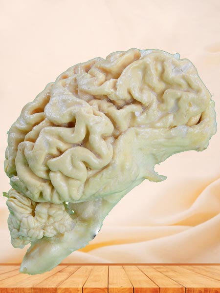 The brain hemisphere of dog plastinated specimen