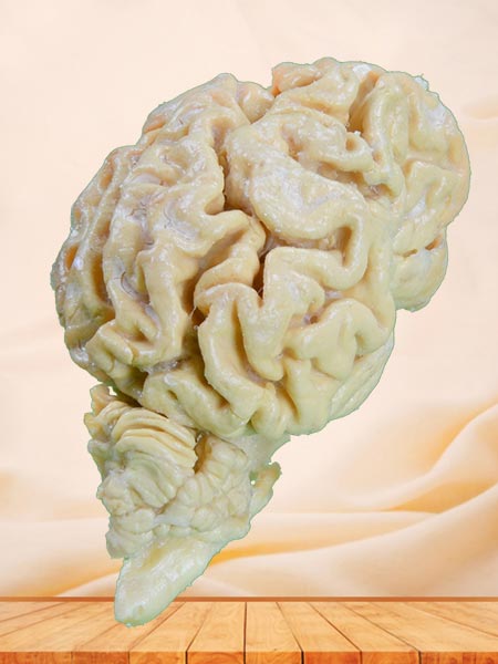 The brain hemisphere of dog plastinated specimen