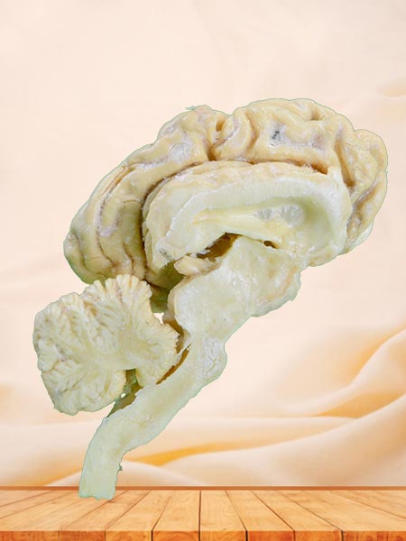 Brain hemisphere of cattle plastinated specimen