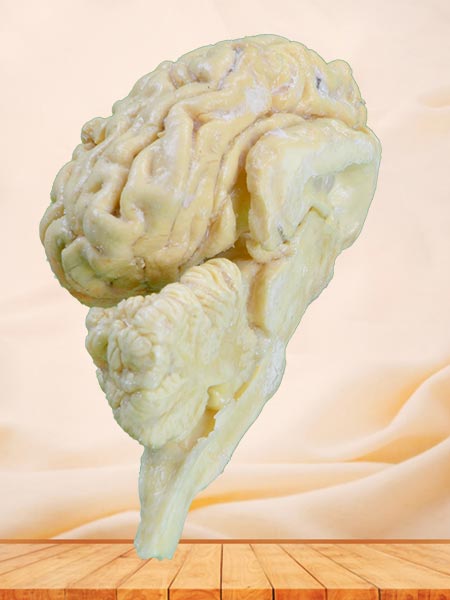 Brain hemisphere of cattle plastinated specimen