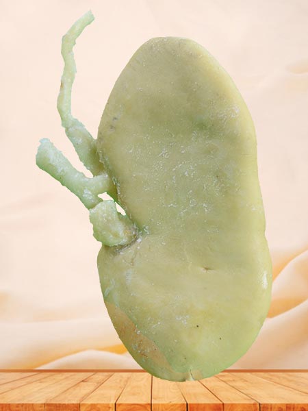 Coronal section of pig kidney plastinated specimen