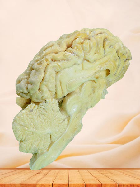 Brain hemisphere of sheep plastinated specimen